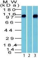 Western blot analysis of human brain lysate in the (1) absence and (2) presence of immunizing peptide, and (3) mouse brain lysate using Anti-beta Catenin Antibody