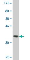 Anti-ZFYVE16 Mouse Monoclonal Antibody [clone: 2E2]