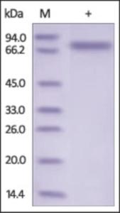 The purity of rh SEMA4A / Semaphorin 4A was determined by DTT-reduced (+) SDS-PAGE and staining overnight with Coomassie Blue.