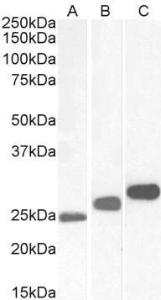 Anti-CSNK2B Antibody (A82928) (0.3 µg/ml) staining of Mouse (A), Rat (B) and Pig (C) Testis lysates (35 µg protein in RIPA buffer). Primary incubation was 1 hour. Detected by chemiluminescence