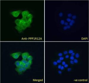 Anti-PPP1R12A antibody