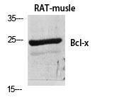 Western blot analysis of various cells using Anti-BCL-XL Antibody