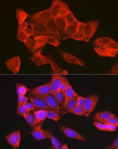 Anti-Thymidylate Synthase antibody