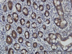 Anti-ZPR1 Mouse Monoclonal Antibody [clone: 6F7]