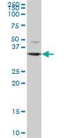 Anti-DECR2 Mouse Polyclonal Antibody