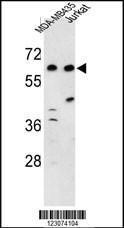 Anti-C19orf26 Rabbit Polyclonal Antibody (APC (Allophycocyanin))