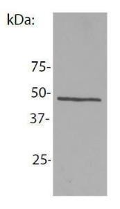 Anti-NCK1 antibody