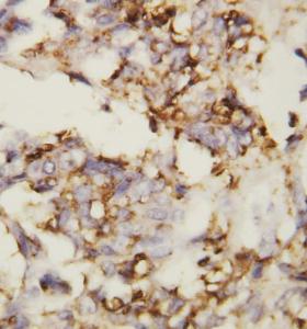 Anti-N Cadherin Rabbit Polyclonal Antibody