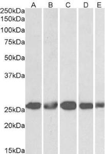 Anti-CSNK2B Antibody (A82928) (1 µg/ml) staining of NIH3T3 (A), HeLa (B), K562 (C), MCF7 (D) and HepG2 (E) lysates (35 µg protein in RIPA buffer). Primary incubation was 1 hour. Detected by chemiluminescence