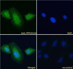 Anti-PPP1R12A antibody