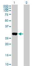 Anti-DLX1 Rabbit Polyclonal Antibody