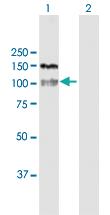 Anti-HDAC4 Rabbit Polyclonal Antibody