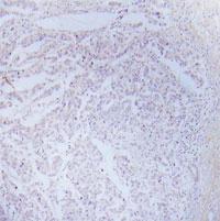 Anti-IKK-alpha/beta Rabbit Polyclonal Antibody