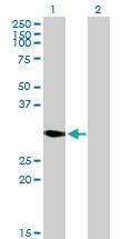 Anti-DECR2 Mouse Polyclonal Antibody