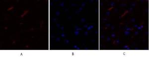 Immunofluorescence analysis of human liver tissue using Anti-mTOR Antibody (red) at 1:200 (4°C overnight). Cy3 labelled secondary antibody was used at 1:300 (RT 50min). Panel A: Target. Panel B: DAPI. Panel C: Merge