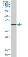 Anti-DLX1 Rabbit Polyclonal Antibody