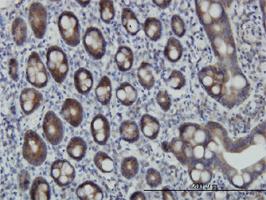 Anti-ZPR1 Mouse Monoclonal Antibody [clone: 6F7]