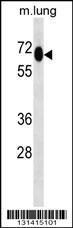 Anti-MEPCE Rabbit Polyclonal Antibody (APC (Allophycocyanin))