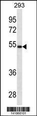 Anti-LGMN Rabbit Polyclonal Antibody (AP (Alkaline Phosphatase))