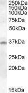 Anti-CTSK Antibody (A84533) (1µg/ml) staining of Human Lung lysate (35µg protein in RIPA buffer). Primary incubation was 1 hour. Detected by chemiluminescence.