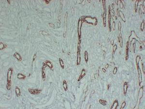 Immunohistochemical analysis of paraffin-embedded human Kidney using Anti-Cytokeratin 8 Antibody