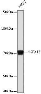 Western blot analysis of extracts of MCF7 cells, using Anti-HSP70 Antibody (A306064) at 1:1,000 dilution. The secondary antibody was Goat Anti-Rabbit IgG H&L Antibody (HRP) at 1:10,000 dilution.