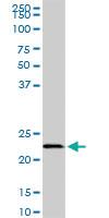 Anti-EFHD1 Mouse Monoclonal Antibody [clone: 1F5]