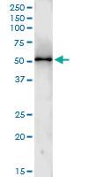 Anti-CCNA2 Polyclonal Antibody Pair