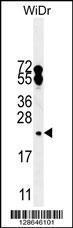 Anti-FA96A Rabbit Polyclonal Antibody (FITC (Fluorescein Isothiocyanate))