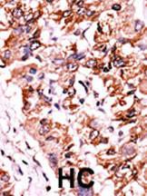 Anti-CHEK1 Rabbit Polyclonal Antibody (PE (Phycoerythrin))