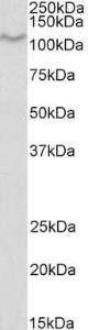 Anti-CD68 Antibody (A82929) (1 µg/ml) staining of U937 lysate (35 µg protein in RIPA buffer) Primary incubation was 1 hour Detected by chemiluminescence