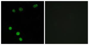 Antibody anti-TP53INP2 100 µg