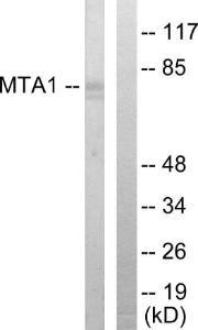 Western blot analysis of lysates from Jurkat cells using Anti-MTA1 Antibody. The right hand lane represents a negative control, where the antibody is blocked by the immunising peptide.