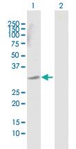 Anti-DECR2 Rabbit Polyclonal Antibody