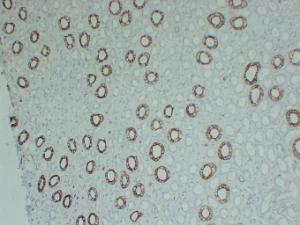 Immunohistochemical analysis of paraffin-embedded human Kidney using Anti-Cytokeratin 8 Antibody