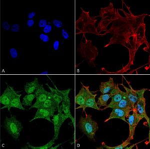 Immunocytochemistry/Immunofluorescence analysis of human neuroblastoma cell line (SK-N-BE, fixed in 4% formaldehyde for 15 min at room temperature, using Anti-ATG4B Antibody (A304912), at 1:100 for 60 minutes at room temperature