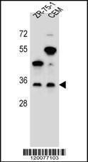 Anti-GPM6B Rabbit Polyclonal Antibody (AP (Alkaline Phosphatase))