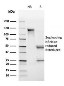 SDS-PAGE analysis of Anti-HLA DP + DQ + DR Antibody [CR3/43] under non-reduced and reduced conditions; showing intact IgG and intact heavy and light chains, respectively. SDS-PAGE analysis confirms the integrity and purity of the Antibody