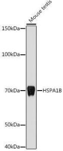 Western blot analysis of extracts of Mouse testis, using Anti-HSP70 Antibody (A306064) at 1:1,000 dilution. The secondary antibody was Goat Anti-Rabbit IgG H&L Antibody (HRP) at 1:10,000 dilution.