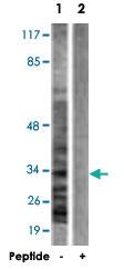 Anti-CASP6 Rabbit Polyclonal Antibody