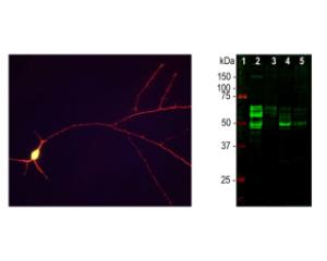 Left: IF staining of E18 hippocampal neurons with chicken anti-Tau antibody (red). Green: Ubiquitin C-terminal Hydrolase 1 (UCHL1). Right: WB analysis of tau protein expression in tissue. [2] rat brain, [3] rat spinal cord, [4] mouse brain, [5] mouse spinal cord.