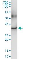 Anti-DECR2 Rabbit Polyclonal Antibody