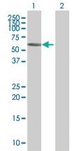 Anti-ZNF502 Mouse Polyclonal Antibody