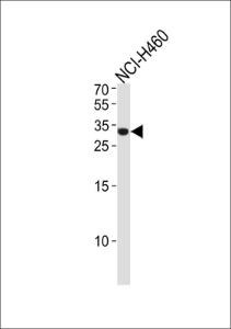 Anti-ASCL1 Rabbit Polyclonal Antibody (Biotin)