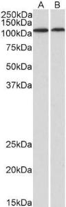 Anti-BMP1 Antibody (A82931) (1 µg/ml) staining of Human Heart (A) and Kidney (B) lysates (35 µg protein in RIPA buffer). Primary incubation was 1 hour. Detected by chemiluminescence