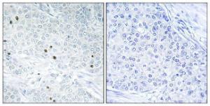 Antibody anti-TP53INP2 100 µg