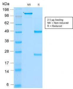 Anti-MyoD1 Mouse Recombinant Antibody [clone: rMYD712]