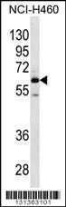 Anti-MEPE Rabbit Polyclonal Antibody (AP (Alkaline Phosphatase))