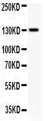 Anti-JAK2 Rabbit Polyclonal Antibody