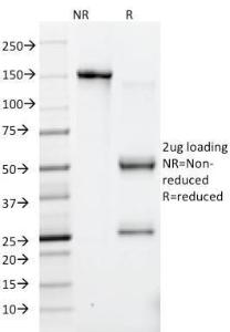 SDS-PAGE analysis of Anti-HSV1 Antibody [10A3] under non-reduced and reduced conditions; showing intact IgG and intact heavy and light chains, respectively SDS-PAGE analysis confirms the integrity and purity of the antibody